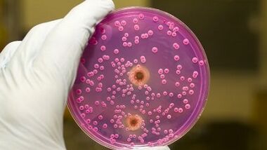 Patologický výtok u mužů, když je nadšený